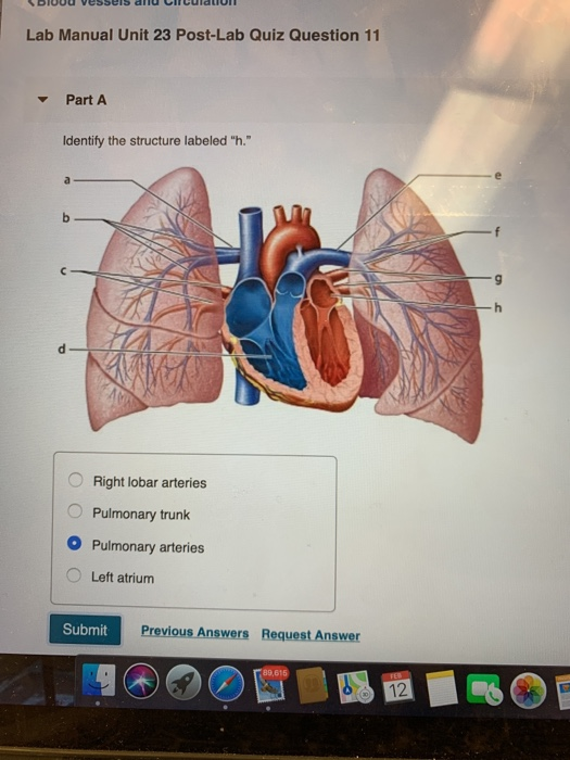 Solved Lab Manual Unit 23 Post Lab Quiz Question 11 Part