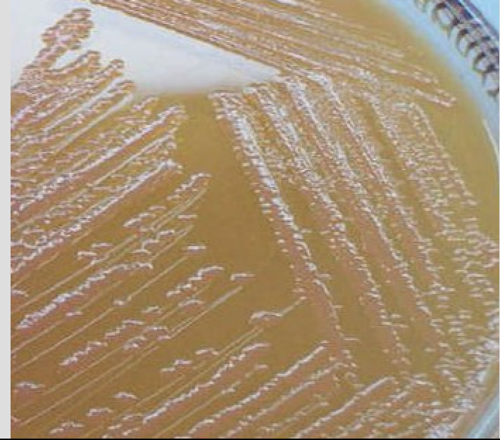 Solved Attached is an image showing a Gram stain of your | Chegg.com