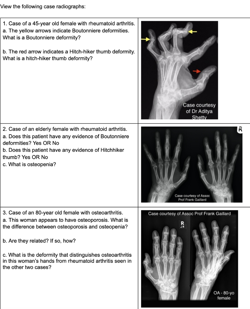 Solved View the following case radiographs: 1. Case of a | Chegg.com