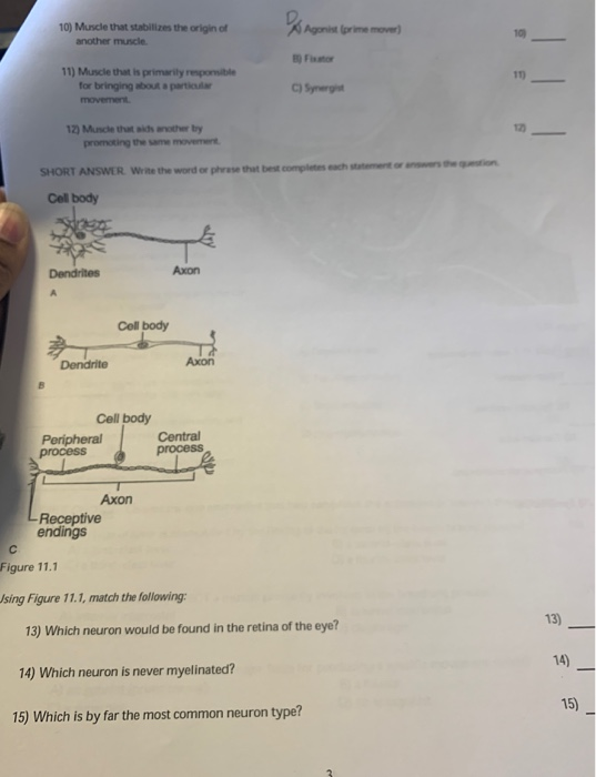 Solved 10 Muscle that stabilizes the origin of 10 another