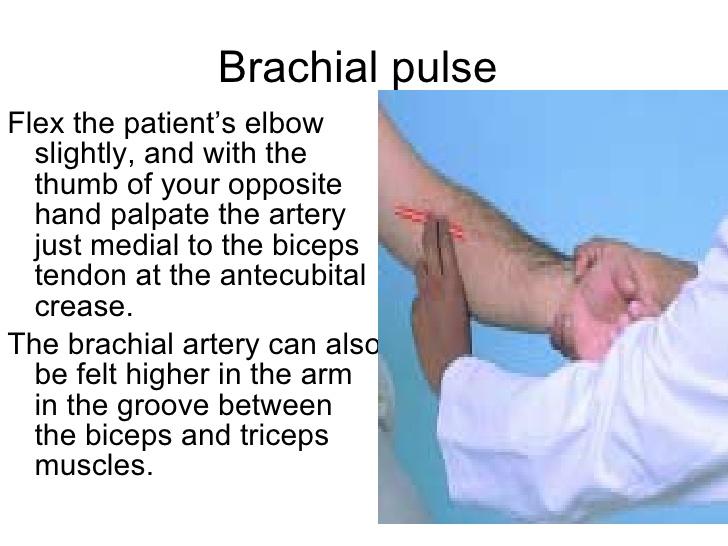 brachial pulse infant