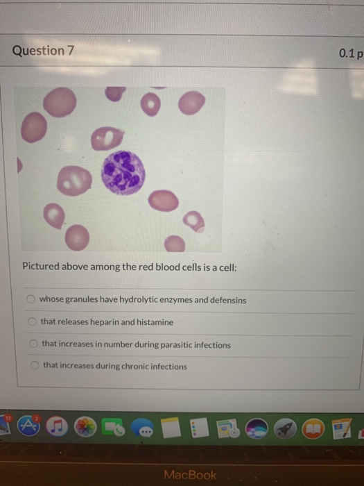 Solved Question 1 0.1pts Blood is composed of % red blood | Chegg.com