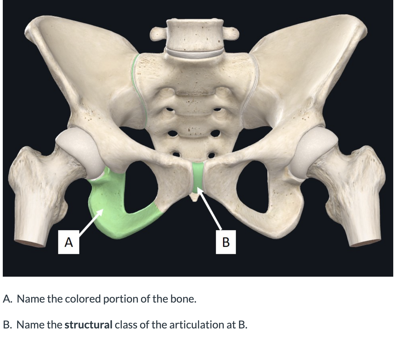 Solved A. Name The Colored Portion Of The Bone. B. Name The | Chegg.com