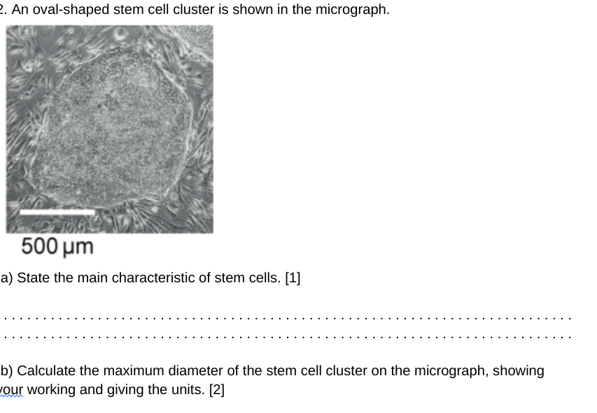 Solved An oval-shaped stem cell cluster is shown in the | Chegg.com
