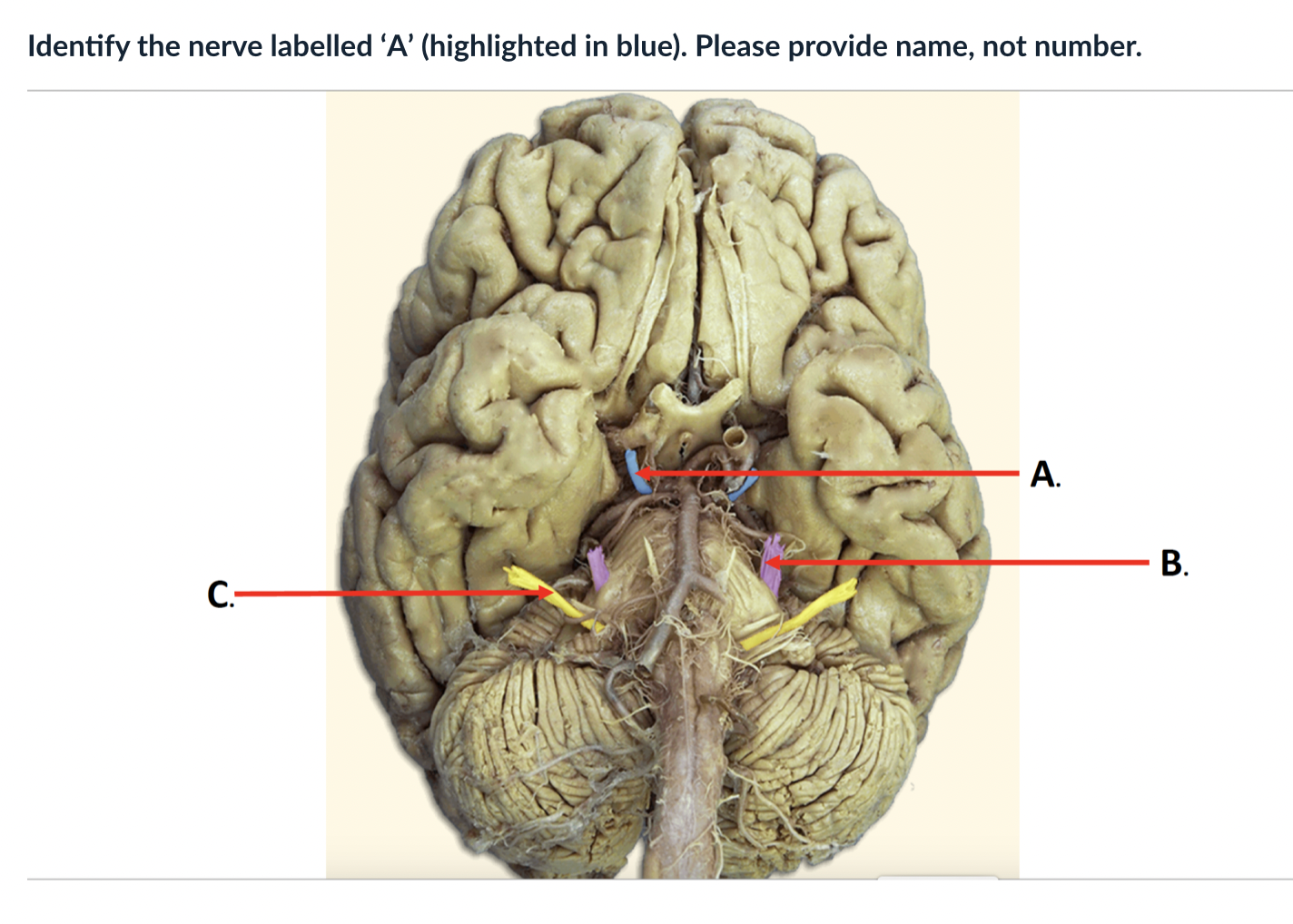 Solved Identify the nerve labelled ' A ' (highlighted in | Chegg.com