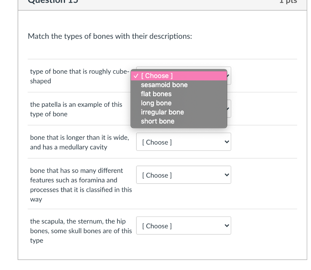 Solved Match The Types Of Bones With Their Descriptions Chegg Com