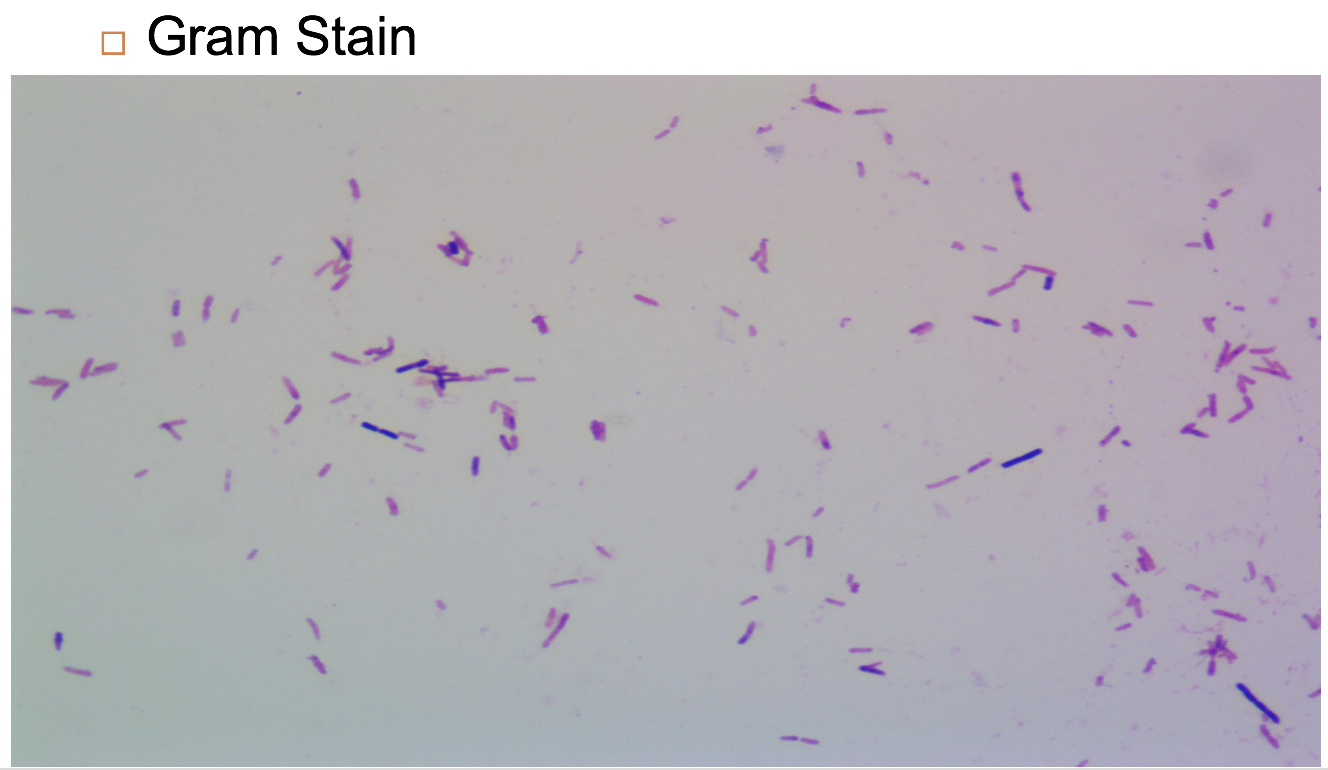 Solved Gram Stain | Chegg.com