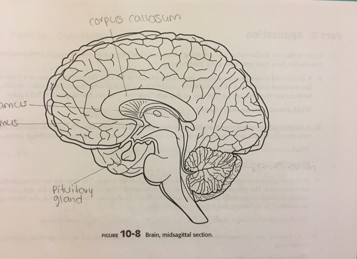 Midsagittal Section Of The Brain Diagram - Ajor Png