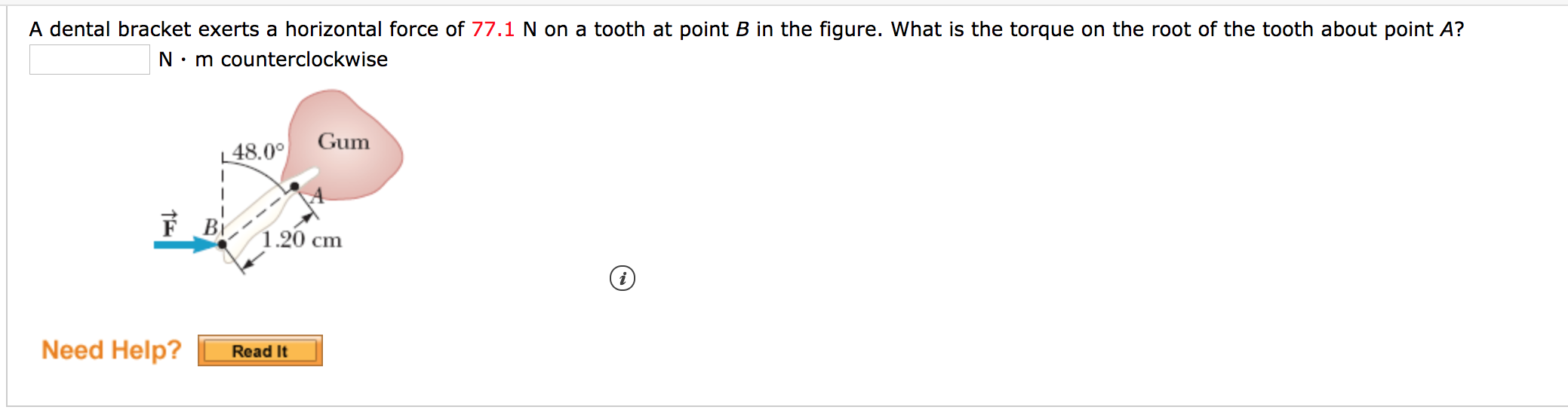 Solved A dental bracket exerts a horizontal force of 77.1 N