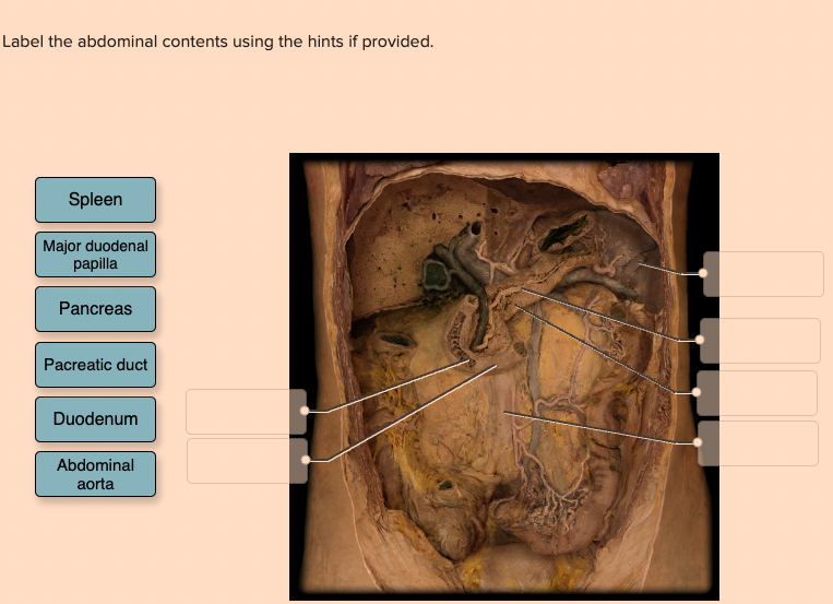 Solved Label the abdominal contents using the hints if