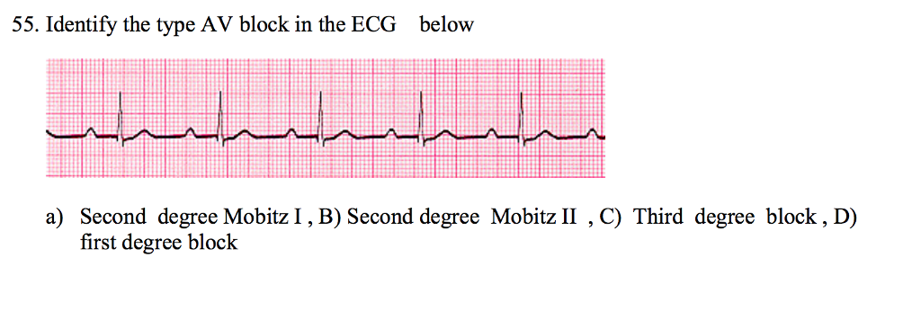 Solved 55. Identify the type AV block in the ECG below a) | Chegg.com