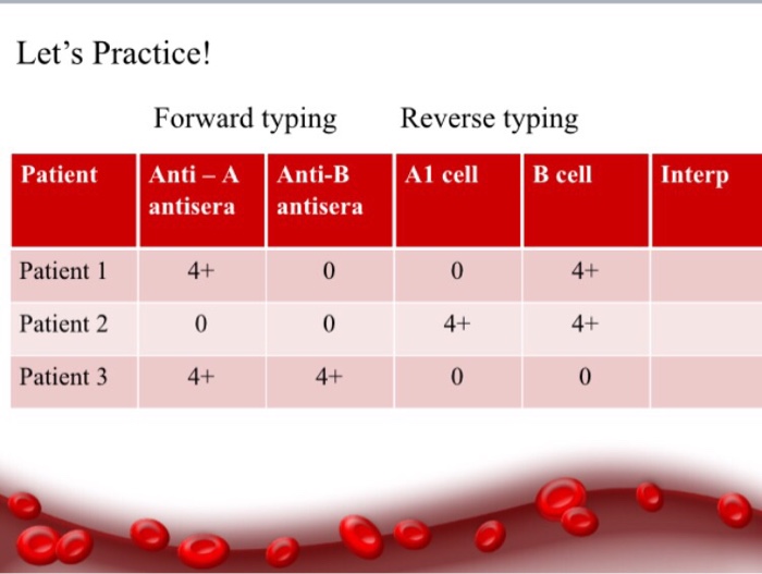 Solved Let's Practice! Forward typing Reverse typing Patient | Chegg.com