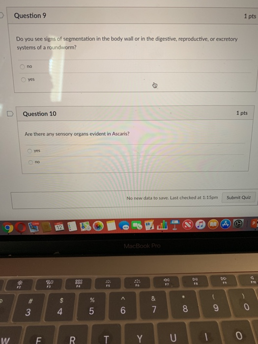 Solved D Question 1 What type of symmetry does a sponge