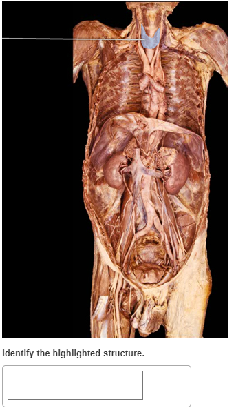 Identify the highlighted structure.
