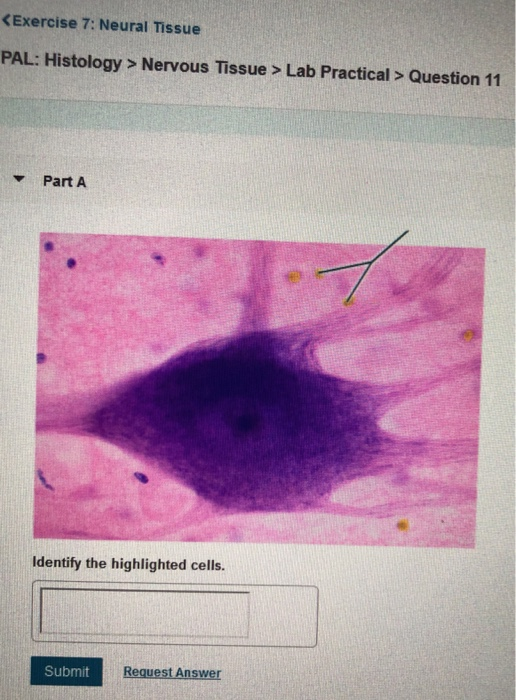 Solved Nervous Tissue > Lab Practical > Question 11 Part A