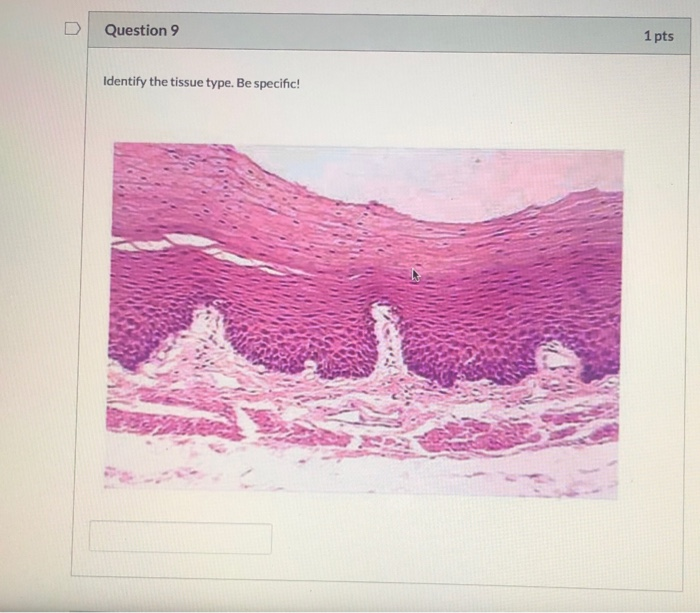 Solved Question 1 1 pts Identify the tissue type. Be | Chegg.com