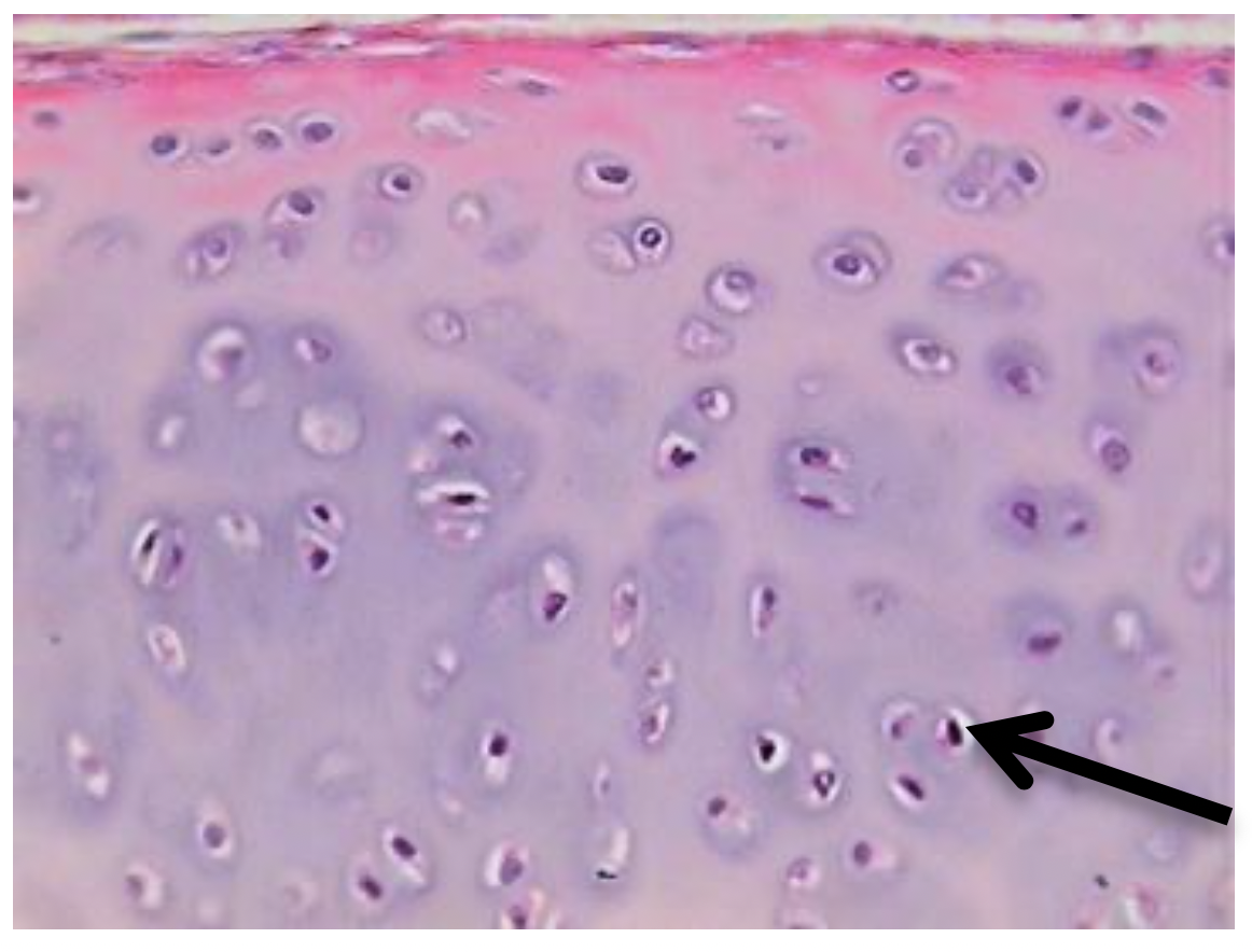 fibrocartilage connective tissue