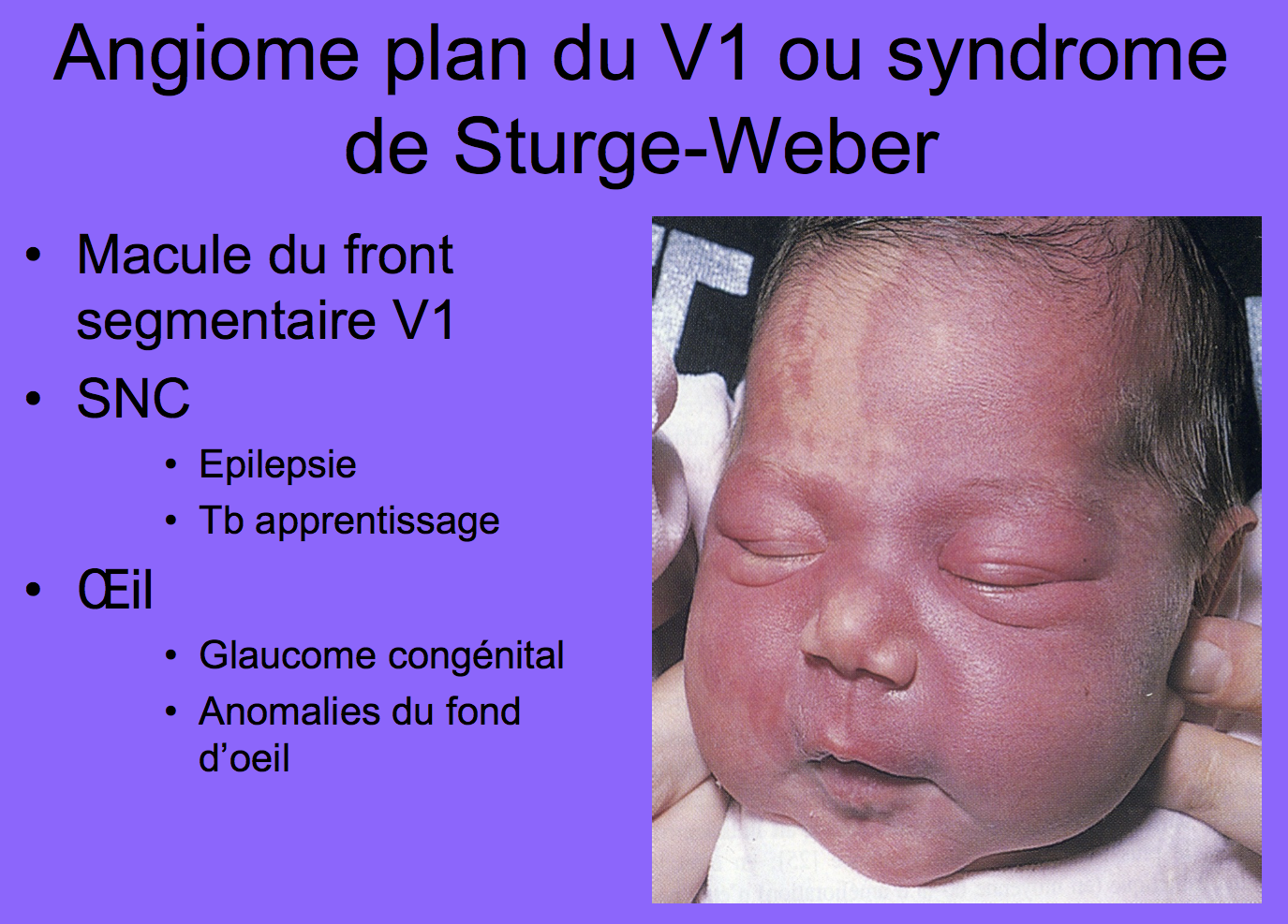 Angiomes Flashcards Chegg Com Angiomes Flashcards Chegg Com