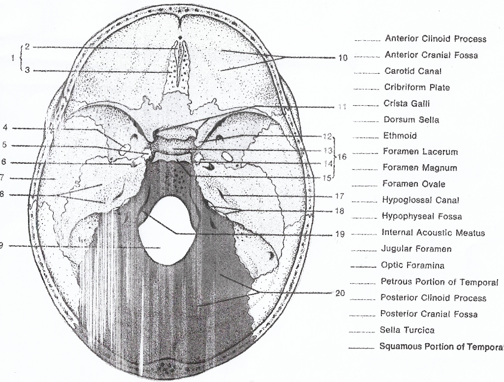 Solved Anterior Clinoid Process Anterior Cranial Fossa My Xxx Hot Girl 7793