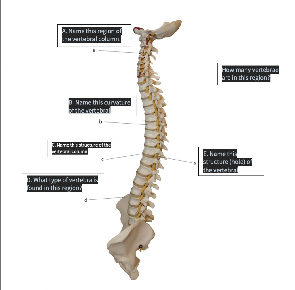 Solved A. Name this region of the vertebral column. How many | Chegg.com