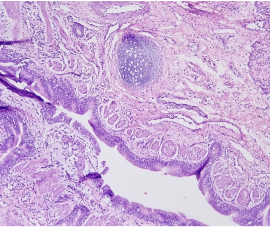 the-patient-is-a-4-month-old-male-baby-born-preterm-chegg