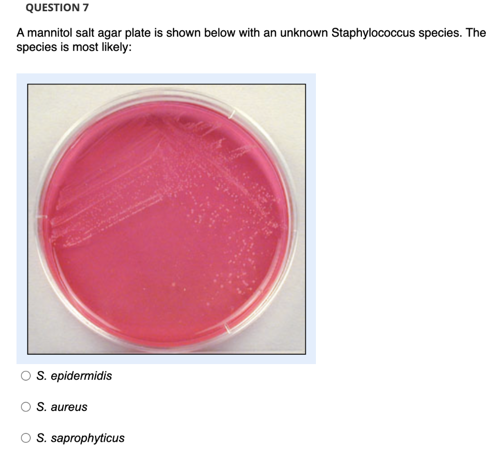 Solved QUESTION 7 A mannitol salt agar plate is shown below | Chegg.com