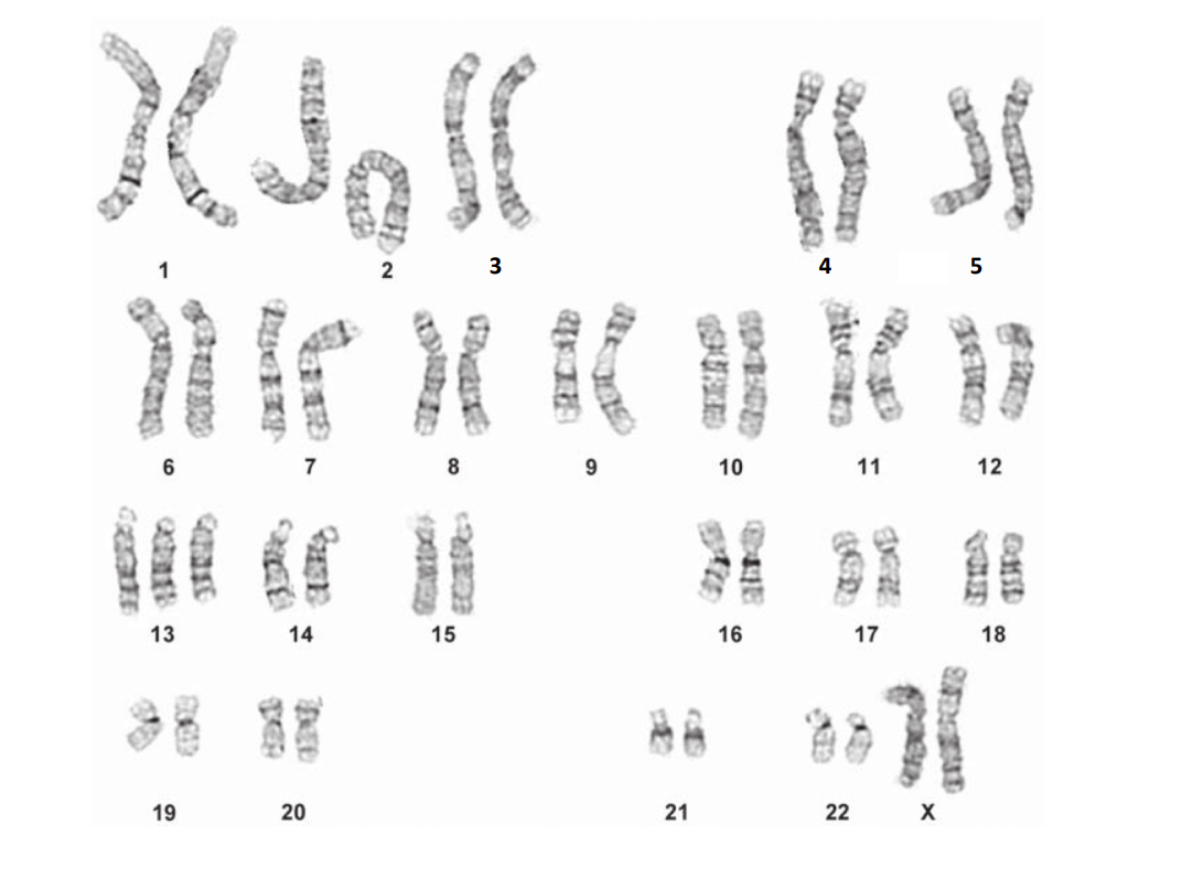 Solved Draw out a possible scenario for how this child (I | Chegg.com