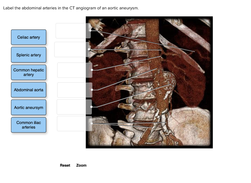Solved Label the abdominal arteries in the CT angiogram of