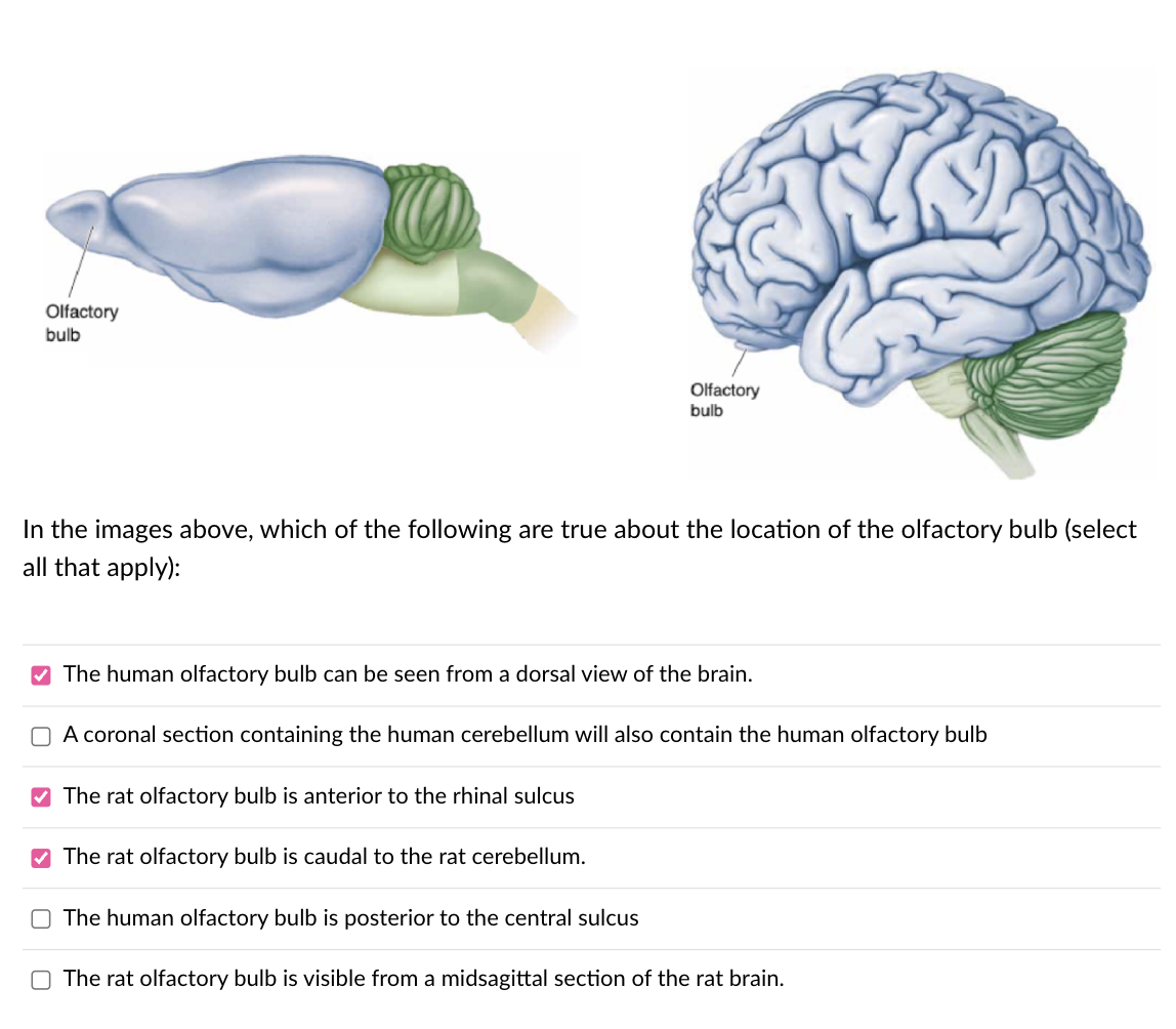 Solved In the images above, which of the following are true | Chegg.com