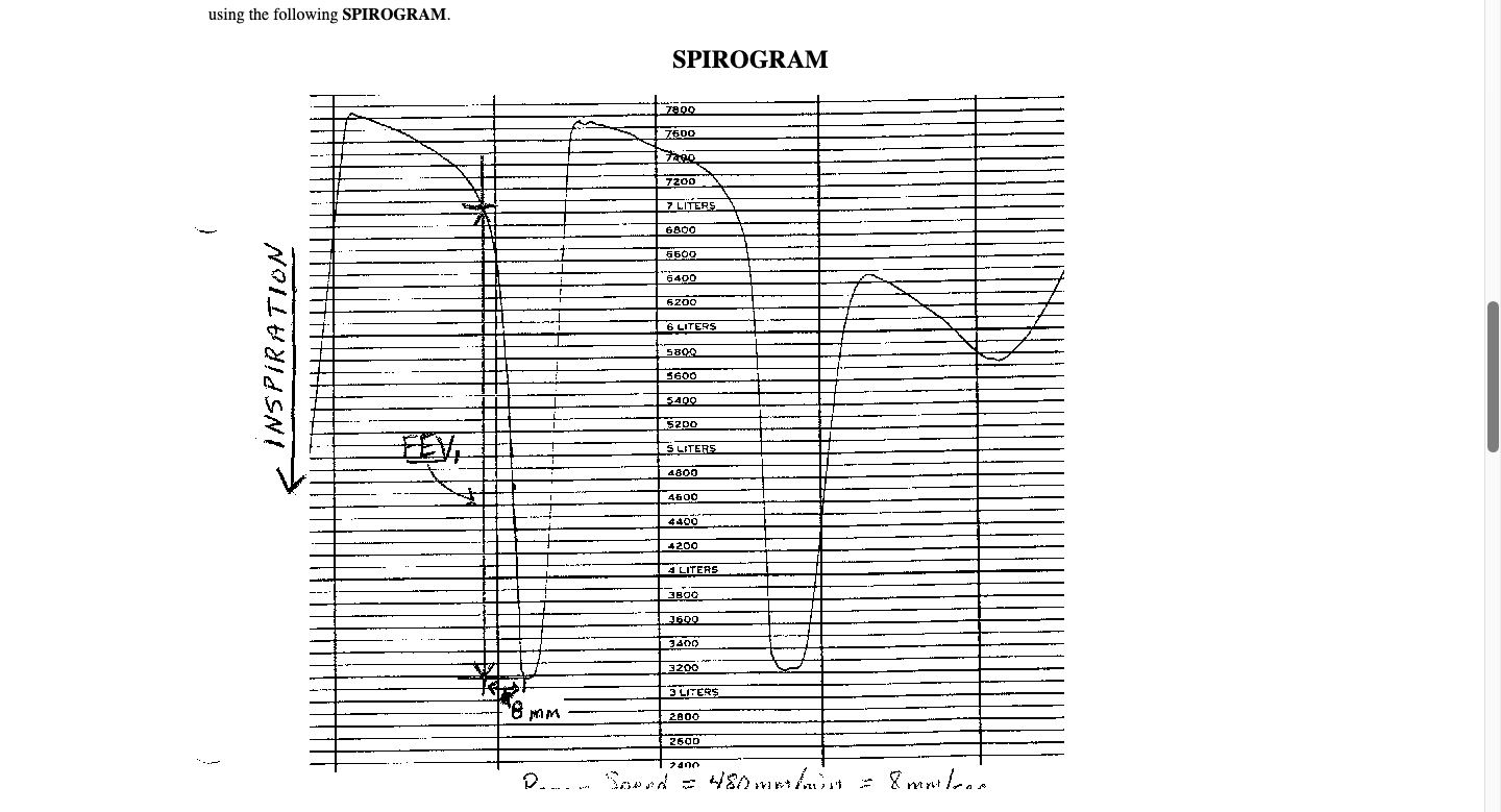 using the following SPIROGRAM.
SPIRNCR AM