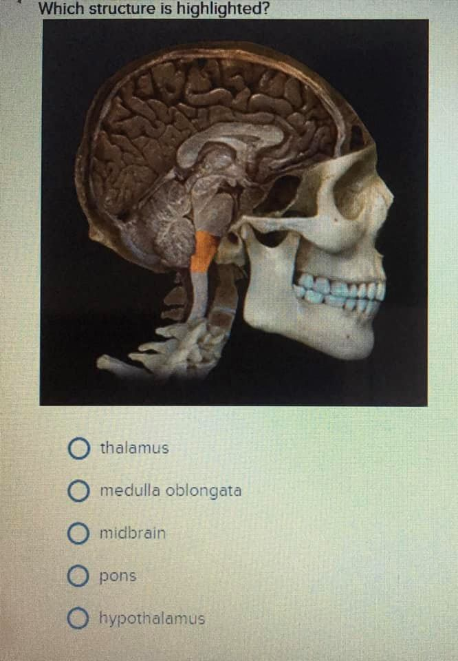 solved-which-structure-is-highlighted-thalamus-medulla-chegg