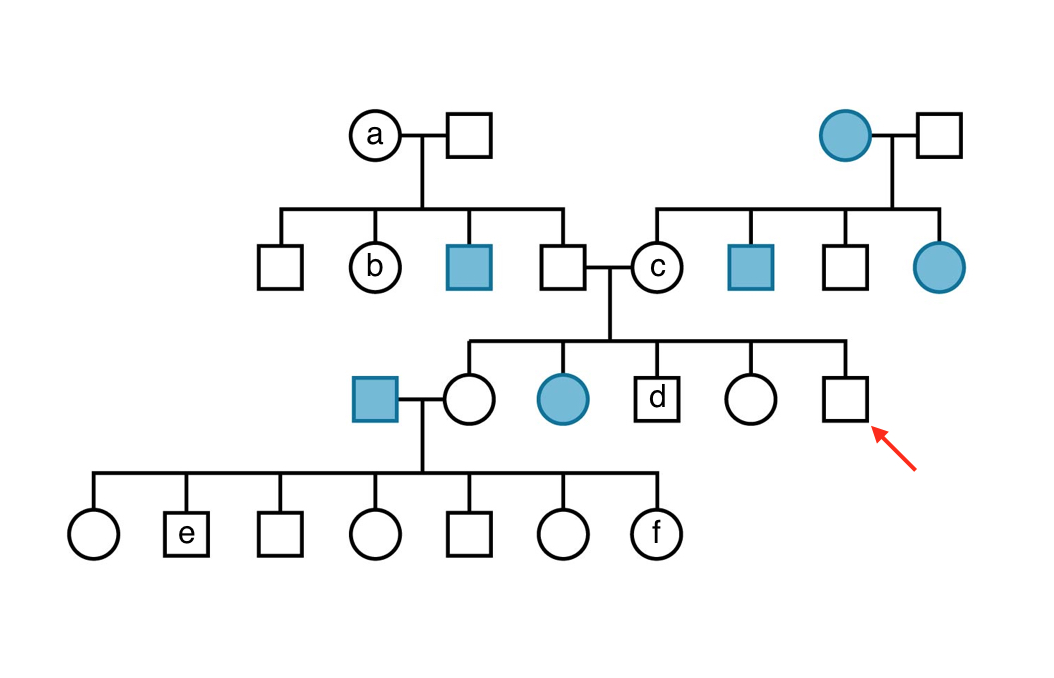 Solved The Pedigree Above Shows The Inheritance Of An 7364