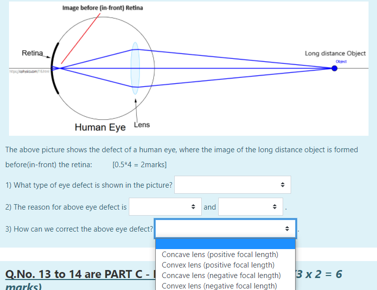 Solved Image before (in-front) Retina Retina Long distance | Chegg.com