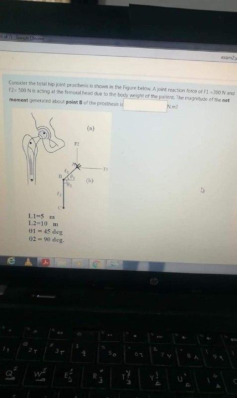 Solved 6 Google Chrome Exam2 Consider The Total Hip Joint | Chegg.com