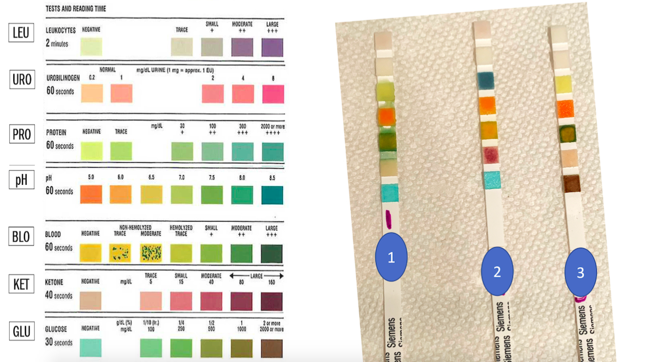 Solved TESTS AND READING TIME LEU TRACE SMALL + MODERATE ++