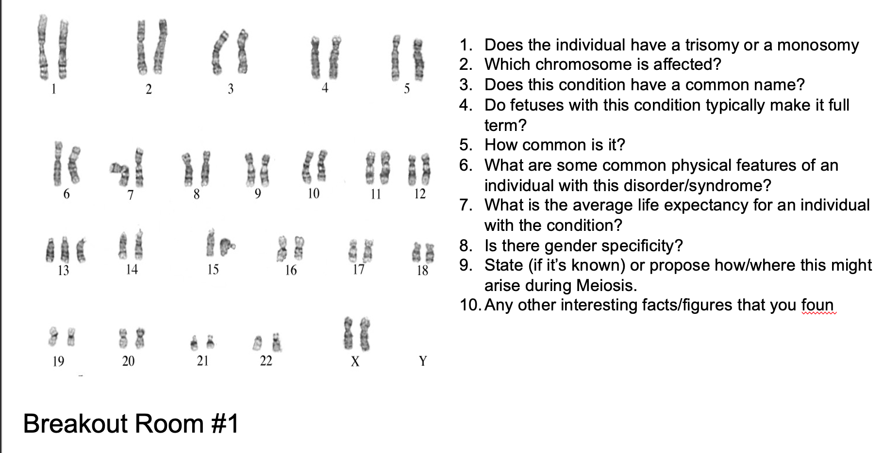 monosomy 13