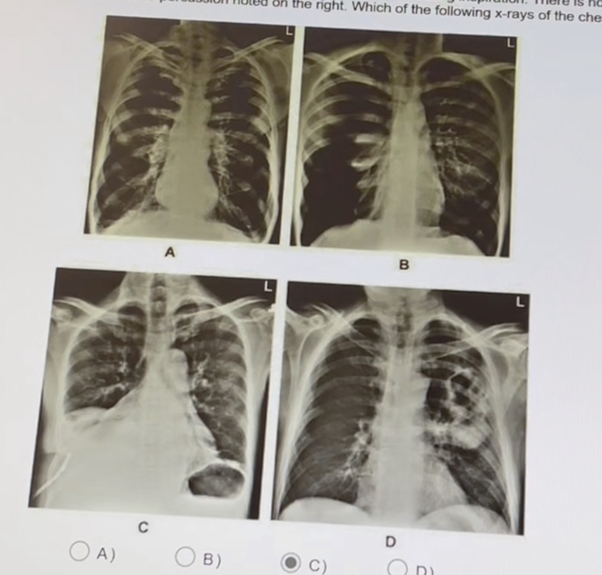solved-a-previously-healthy-27-year-old-patient-has-the-chegg