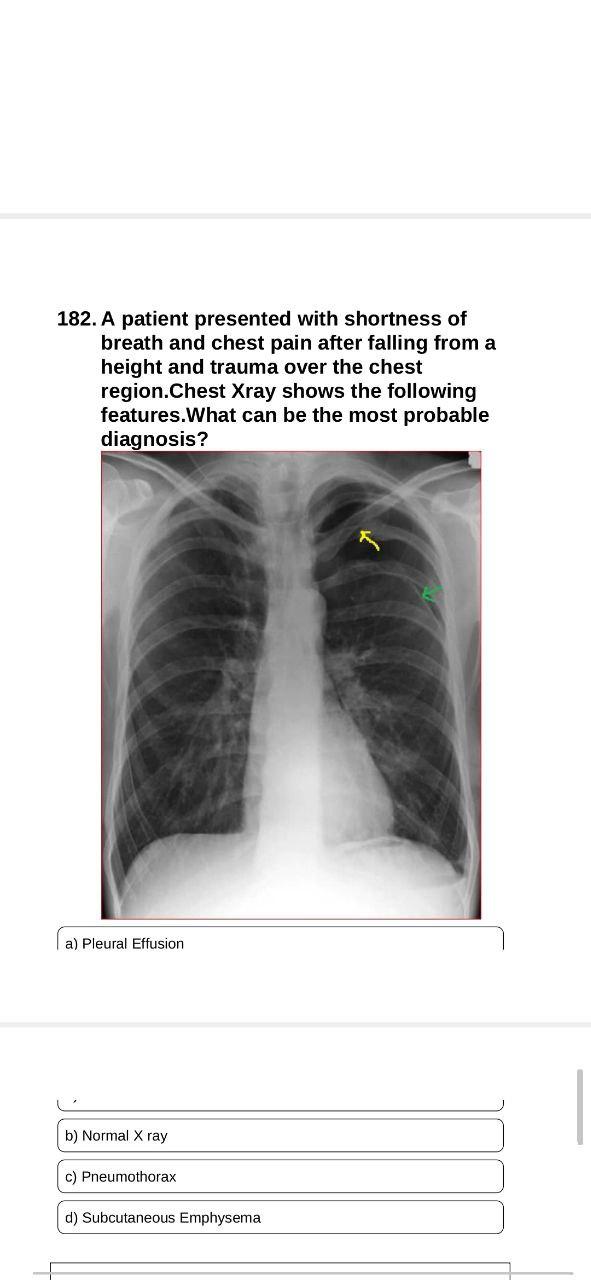 Solved 182. A patient presented with shortness of breath and | Chegg.com