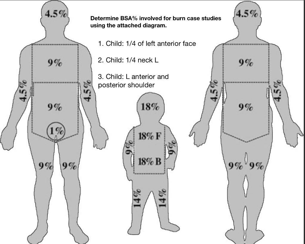Solved 4.5 4.5 Determine BSA involved for burn case