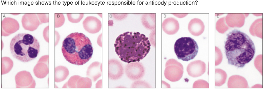 Solved Which Image Shows The Type Of Leukocyte Responsible | Chegg.com