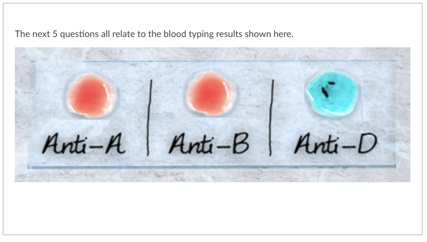Solved 1. Based on the blood typing results shown above,