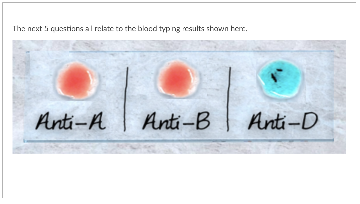 Solved 1. Based On The Blood Typing Results Shown Above, | Chegg.com