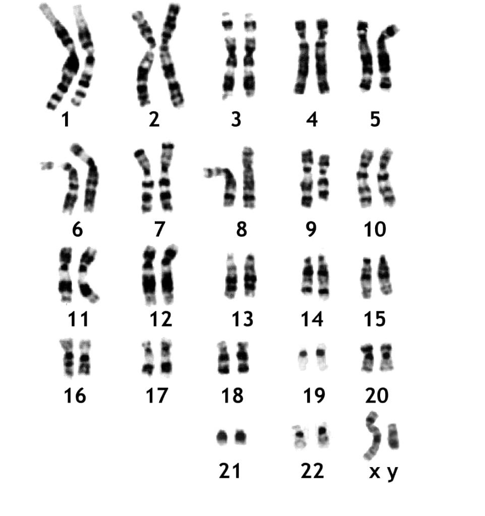 Solved The karyotype shown was from a | Chegg.com