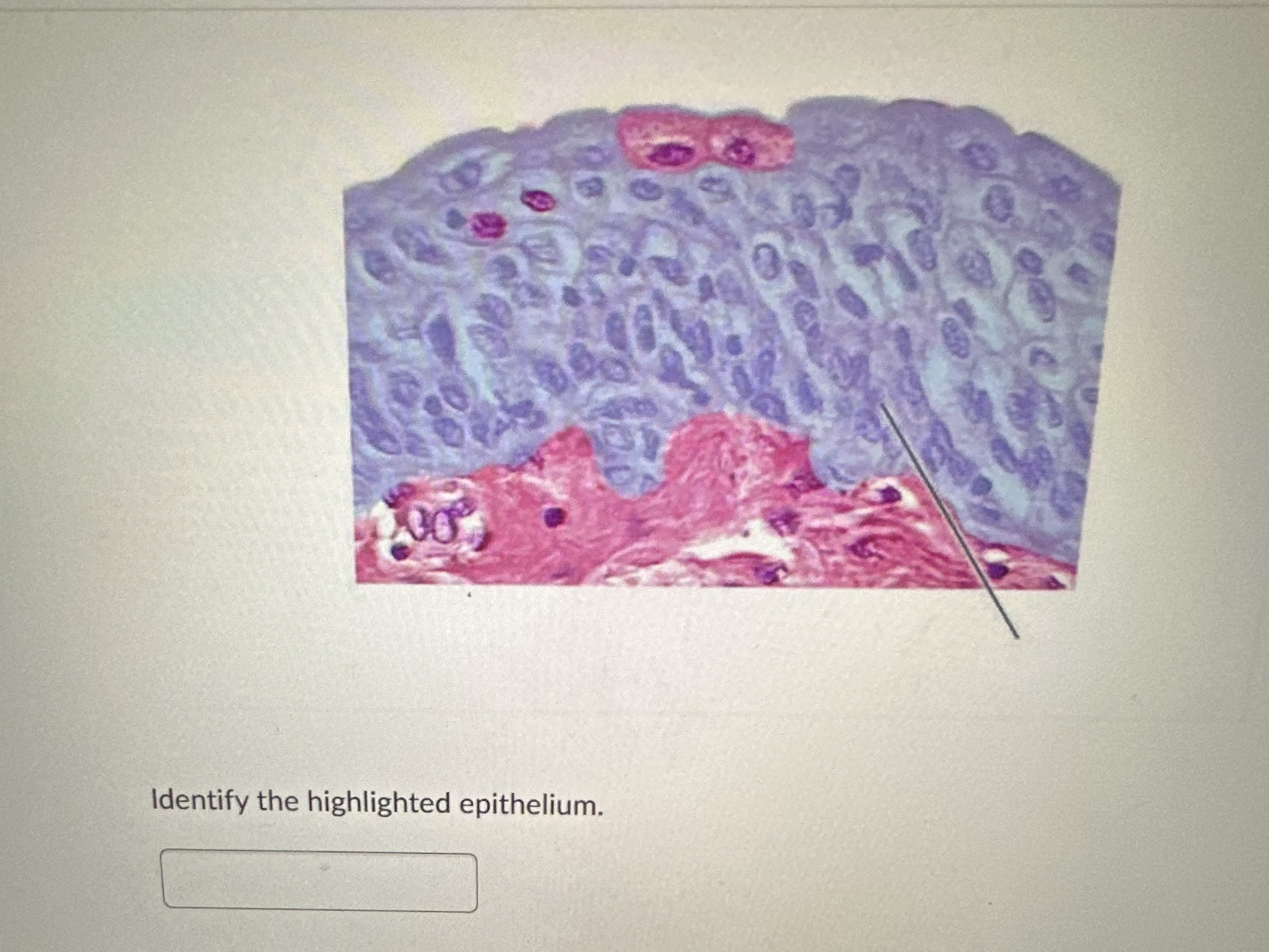 Solved Identify the highlighted epithelium. | Chegg.com