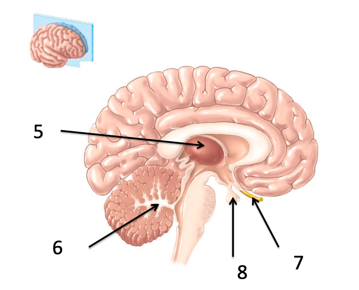 Solved 1 3 2 Dissection Shawn Miller, Photograph Mark | Chegg.com