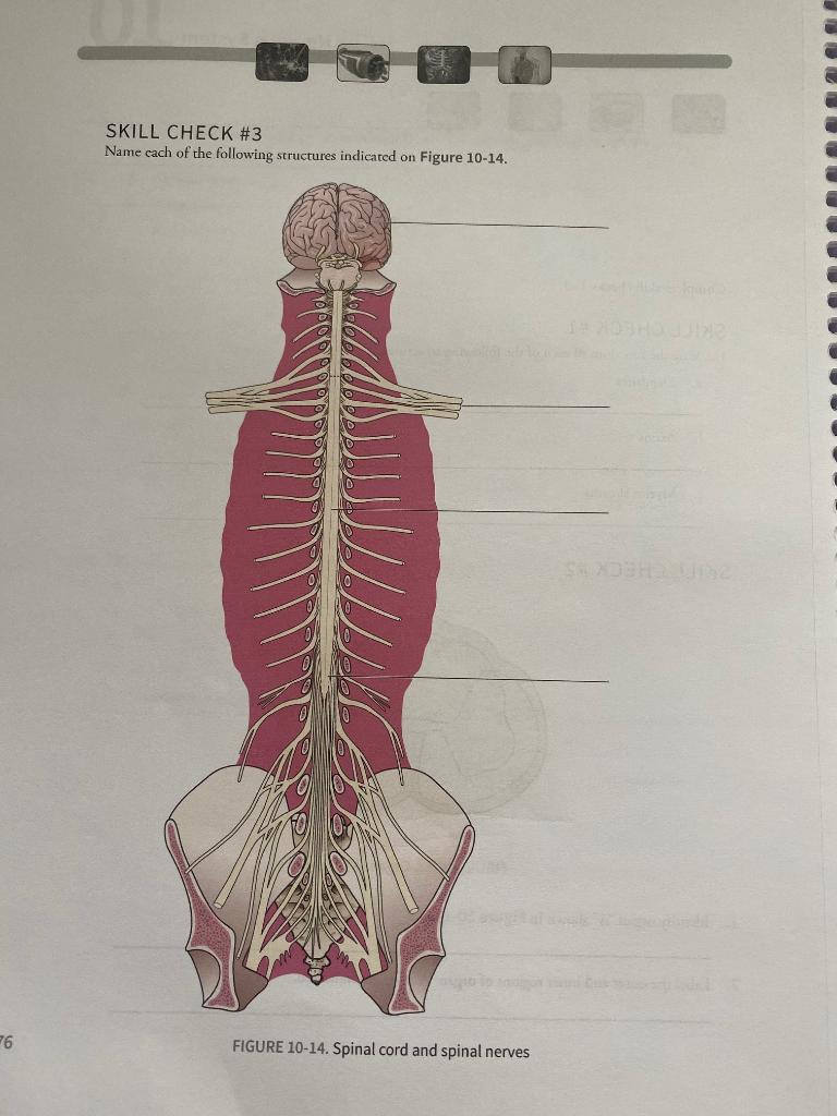 SKILL CHECK #3 Name cach of the following structures indicated on Figure 10-14. 26 FIGURE 10-14. Spinal cord and spinal nerve