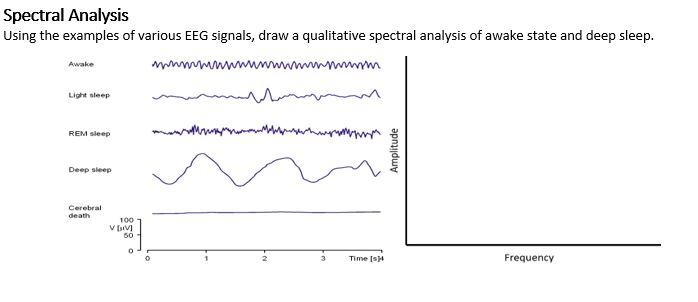 Solved Spectral Analysis Using the examples of various EEG | Chegg.com