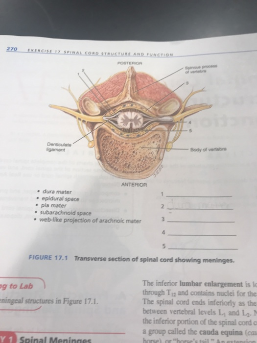 Solved Posterior Ligament Body Of Versbra Anterior . Dura 