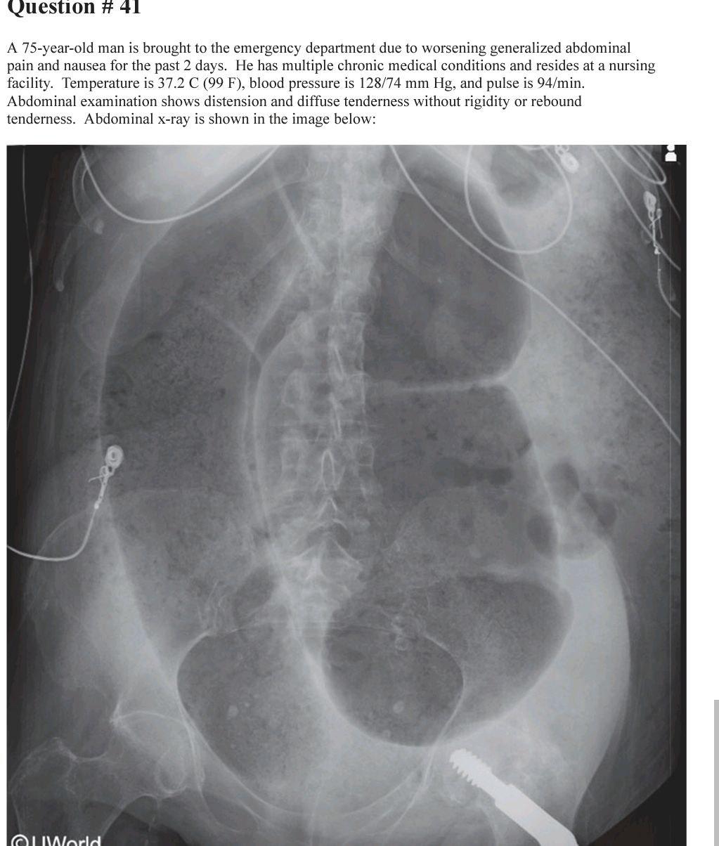 Question # 41 A 75-year-old man is brought to the | Chegg.com