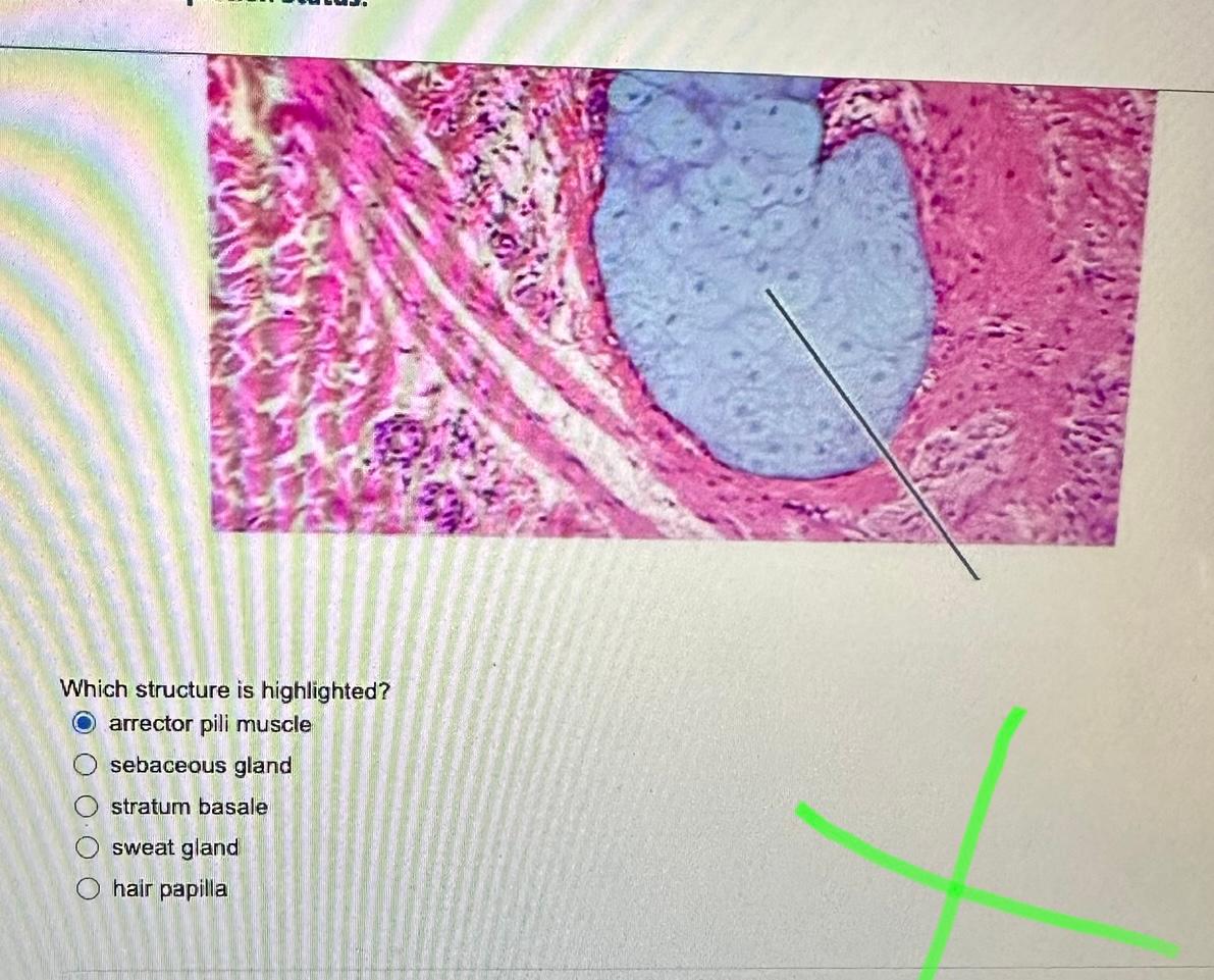 Solved Which structure is highlighted? arrector pili muscle | Chegg.com